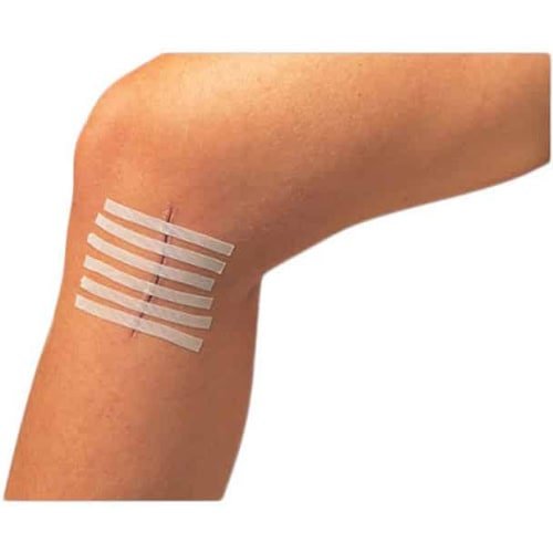 Steri-Strip-2